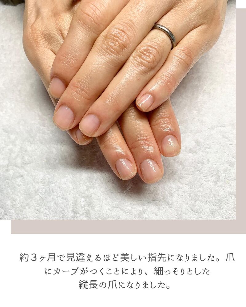 画像1320