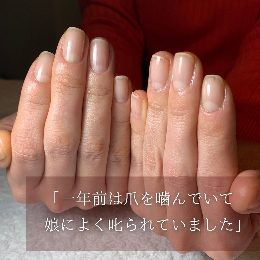 画像1414