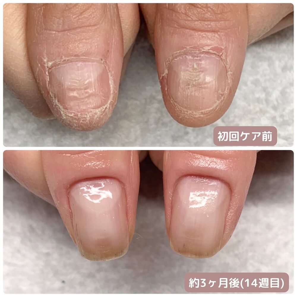 画像1417