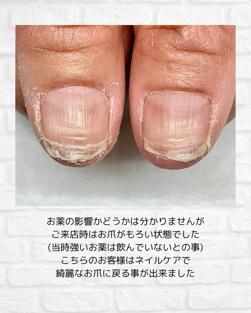 画像1619